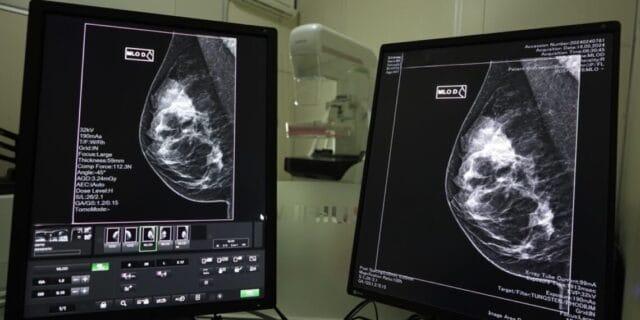 Imagem representativa de um mutirão de mamografias em Florianópolis