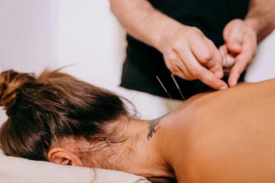 Mulher recebendo tratamento de acupuntura para fibromialgia